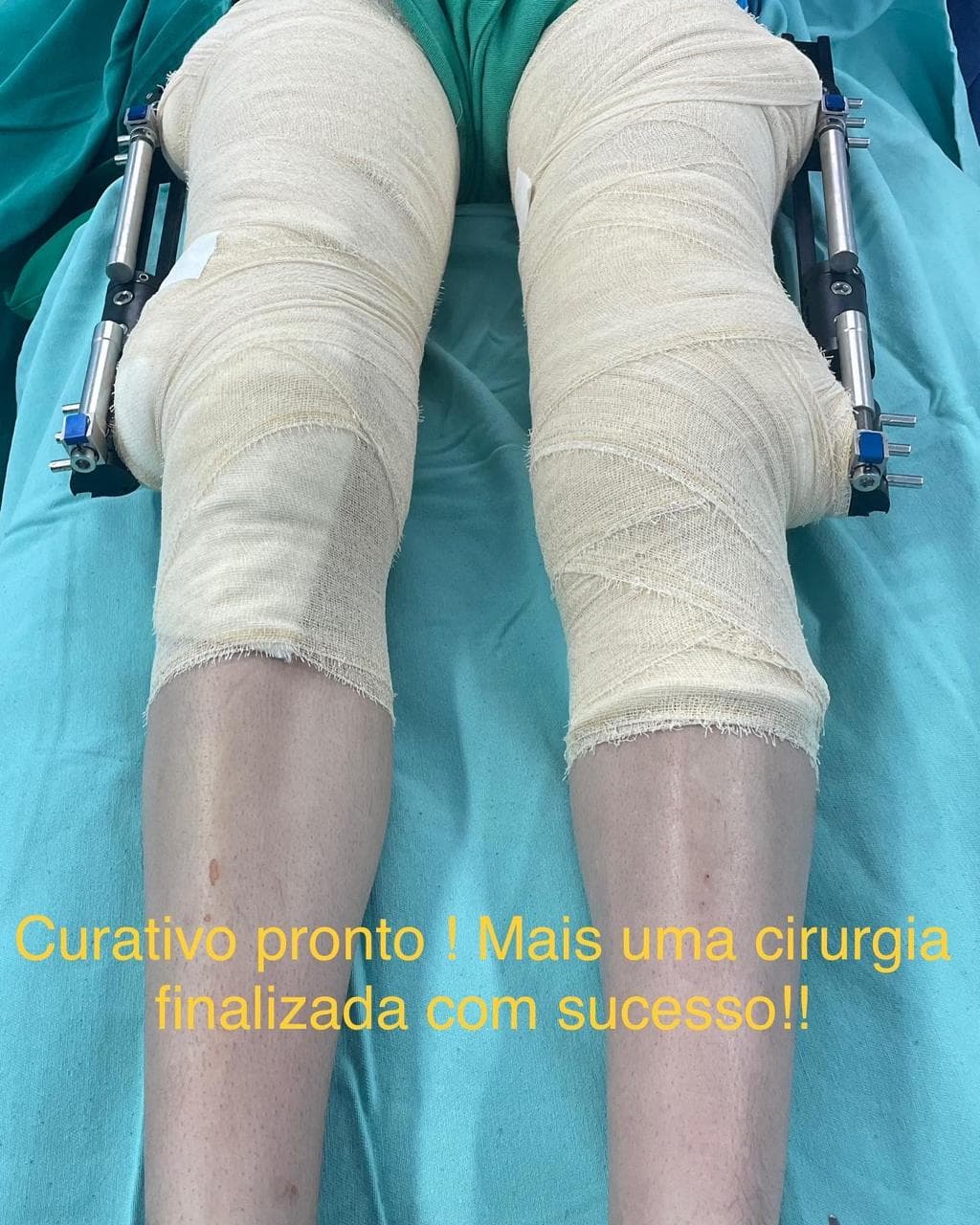 Primeiro curativo após a cirurgia — cuidado clínico documentado com autorização.